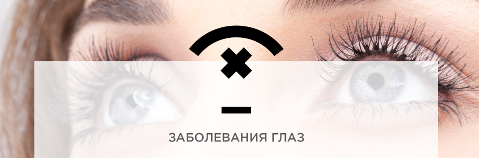 ЗАБОЛЕВАНИЯ ГЛАЗ